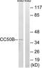 Transmembrane Protein 30B antibody, TA316187, Origene, Western Blot image 