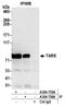 Threonyl-TRNA Synthetase antibody, A304-755A, Bethyl Labs, Immunoprecipitation image 