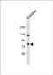 ADAM Metallopeptidase Domain 21 antibody, PA5-72283, Invitrogen Antibodies, Western Blot image 