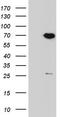 Protein Phosphatase 2 Regulatory Subunit B'Delta antibody, TA804105S, Origene, Western Blot image 