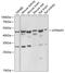 ATPase H+ Transporting Accessory Protein 2 antibody, GTX64438, GeneTex, Western Blot image 