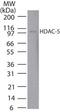 Histone deacetylase 5 antibody, TA336892, Origene, Western Blot image 