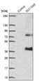 Solute Carrier Family 13 Member 5 antibody, NBP1-92394, Novus Biologicals, Western Blot image 