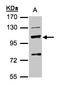 Mannosidase Beta antibody, LS-C185523, Lifespan Biosciences, Western Blot image 