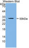Laminin subunit beta-3 antibody, LS-C314885, Lifespan Biosciences, Western Blot image 