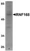 E3 ubiquitin-protein ligase RNF168 antibody, NBP1-76324, Novus Biologicals, Western Blot image 