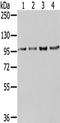 Nuclear pore complex protein Nup98-Nup96 antibody, TA351902, Origene, Western Blot image 