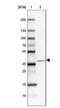 ATPase H+ Transporting V0 Subunit D2 antibody, NBP2-31600, Novus Biologicals, Western Blot image 