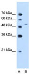 PBEF antibody, TA346417, Origene, Western Blot image 