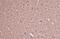 Dihydropyrimidinase Like 2 antibody, NBP1-31762, Novus Biologicals, Immunohistochemistry paraffin image 