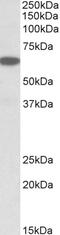 Phospholipase A2 Group IVC antibody, 43-261, ProSci, Western Blot image 