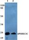 Probable DNA dC->dU-editing enzyme APOBEC-3C antibody, A07527, Boster Biological Technology, Western Blot image 