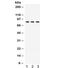 P21 (RAC1) Activated Kinase 5 antibody, R32341, NSJ Bioreagents, Western Blot image 