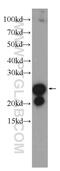 Sm22 antibody, 10493-1-AP, Proteintech Group, Western Blot image 
