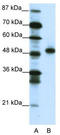 Homeobox protein MOX-2 antibody, TA343570, Origene, Western Blot image 