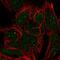 NEFH antibody, HPA061615, Atlas Antibodies, Immunofluorescence image 