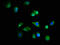 Chromosome 19 Open Reading Frame 12 antibody, LS-C674686, Lifespan Biosciences, Immunofluorescence image 