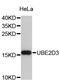 Ubiquitin Conjugating Enzyme E2 D3 antibody, STJ26015, St John