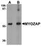 Myocardial Zonula Adherens Protein antibody, A13349, Boster Biological Technology, Western Blot image 