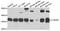 Cytochrome B5 Reductase 3 antibody, STJ29673, St John