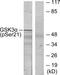 Glycogen Synthase Kinase 3 Alpha antibody, TA312687, Origene, Western Blot image 