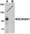 Zinc Finger CCCH-Type Containing, Antiviral 1 antibody, 5839, ProSci, Western Blot image 
