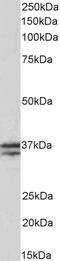 sTnT antibody, LS-B10398, Lifespan Biosciences, Western Blot image 