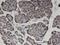 Zinc Finger Protein 44 antibody, H00051710-M01, Novus Biologicals, Immunohistochemistry paraffin image 