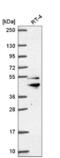 Zinc Finger FYVE-Type Containing 27 antibody, NBP2-56872, Novus Biologicals, Western Blot image 