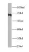 Phosphatidylinositol-4-phosphate 5-kinase type-1 alpha antibody, FNab06463, FineTest, Western Blot image 