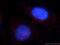 Ceramide Synthase 2 antibody, 20344-1-AP, Proteintech Group, Immunofluorescence image 