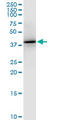 Pentraxin 3 antibody, LS-C198038, Lifespan Biosciences, Western Blot image 