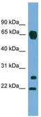 Matrix Metallopeptidase 26 antibody, TA344719, Origene, Western Blot image 