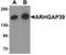 Rho GTPase Activating Protein 39 antibody, A14221, Boster Biological Technology, Western Blot image 