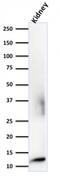 B2M antibody, AE00142, Aeonian Biotech, Western Blot image 