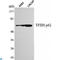 General Transcription Factor IIH Subunit 1 antibody, LS-C813133, Lifespan Biosciences, Western Blot image 