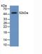 Amyloid P Component, Serum antibody, LS-C420638, Lifespan Biosciences, Western Blot image 