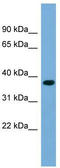 Regulation Of Nuclear Pre-MRNA Domain Containing 1B antibody, TA344726, Origene, Western Blot image 