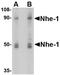 Solute Carrier Family 9 Member A1 antibody, NBP1-76848, Novus Biologicals, Western Blot image 