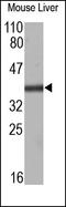 Lymphatic Vessel Endothelial Hyaluronan Receptor 1 antibody, 251673, Abbiotec, Western Blot image 
