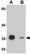 Receptor Accessory Protein 3 antibody, GTX85210, GeneTex, Western Blot image 