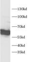 Prolyl 4-hydroxylase subunit alpha-1 antibody, FNab10712, FineTest, Western Blot image 