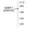 G3BP Stress Granule Assembly Factor 1 antibody, AP01589PU-N, Origene, Western Blot image 