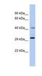 ADP Ribosylation Factor Like GTPase 14 Effector Protein antibody, NBP1-56478, Novus Biologicals, Western Blot image 