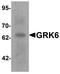 G Protein-Coupled Receptor Kinase 6 antibody, PA5-72790, Invitrogen Antibodies, Western Blot image 