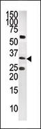Carboxy-terminal domain RNA polymerase II polypeptide A small phosphatase 1 antibody, MBS9203230, MyBioSource, Western Blot image 
