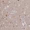 Proline Rich 5 antibody, HPA054072, Atlas Antibodies, Immunohistochemistry paraffin image 