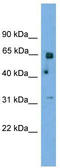 Bifunctional polynucleotide phosphatase/kinase antibody, TA340167, Origene, Western Blot image 