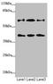 Decapping MRNA 1A antibody, LS-C675622, Lifespan Biosciences, Western Blot image 