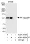 Nuclear Factor Kappa B Subunit 1 antibody, A301-820A, Bethyl Labs, Immunoprecipitation image 